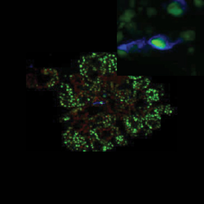 pancreaticorganoid